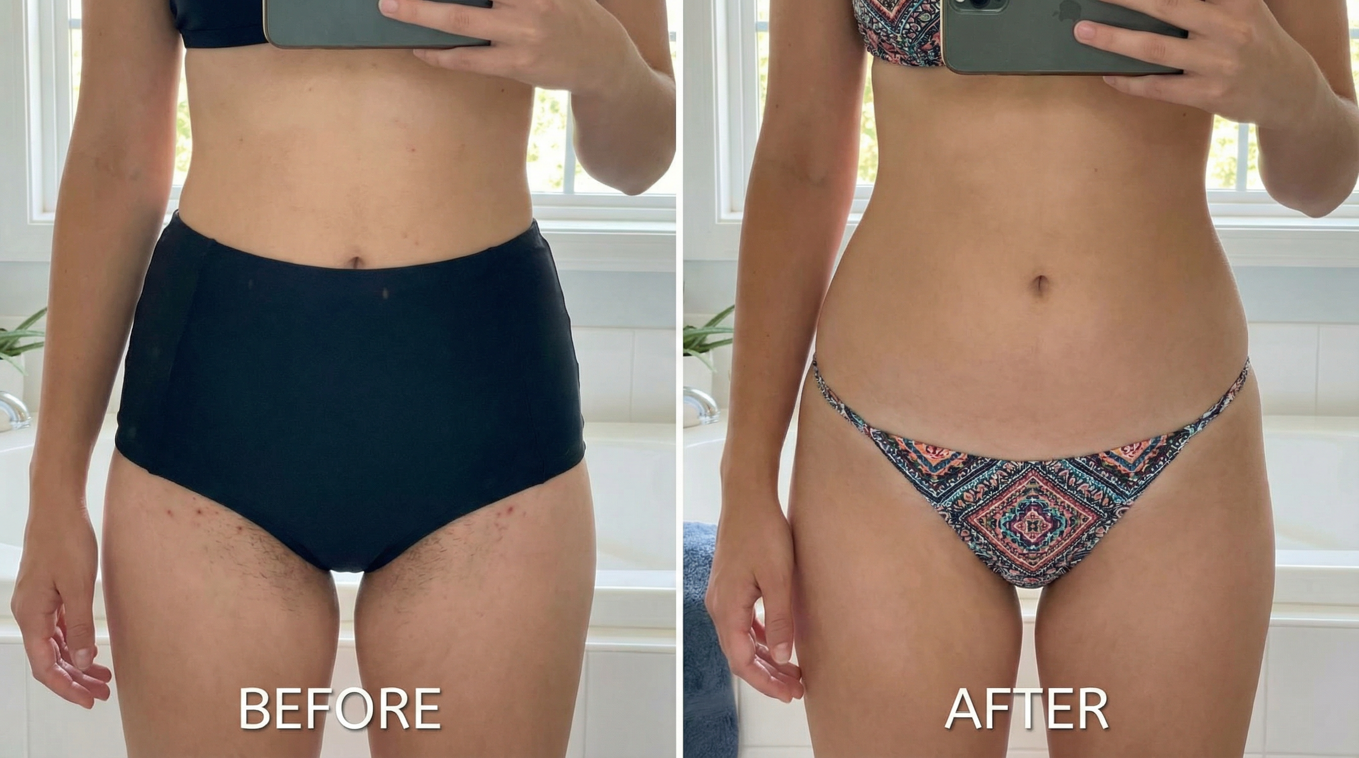 Before and After - Brazilian treatment